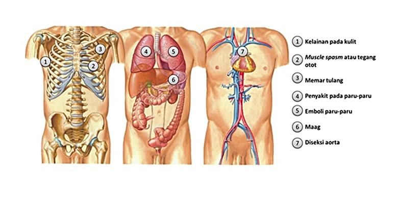 nyeri-dada-segera-periksa-ke-dokter_15.jpg